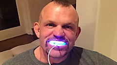 Want The Secret To 'Celebrity White' Teeth?